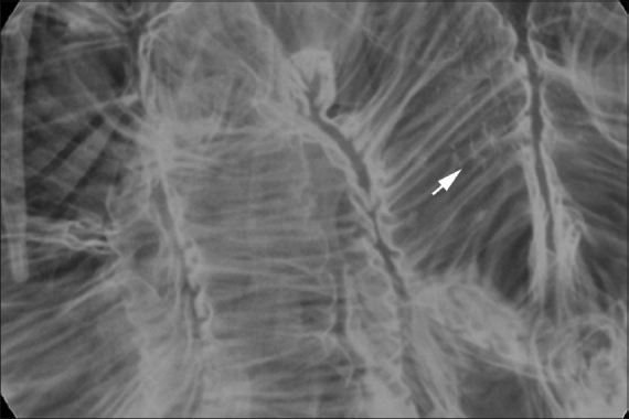 Recent advances in intestinal imaging 2021