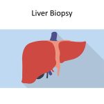 liver biopsy