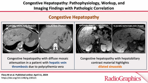 liver congestion